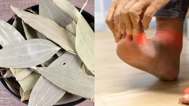 Uric acid: डॉक्टर भी रह गए हैरान! तेजपत्ता ऐसे करता है यूरिक एसिड को कंट्रोल, जानिए चमत्कारी तरीका!