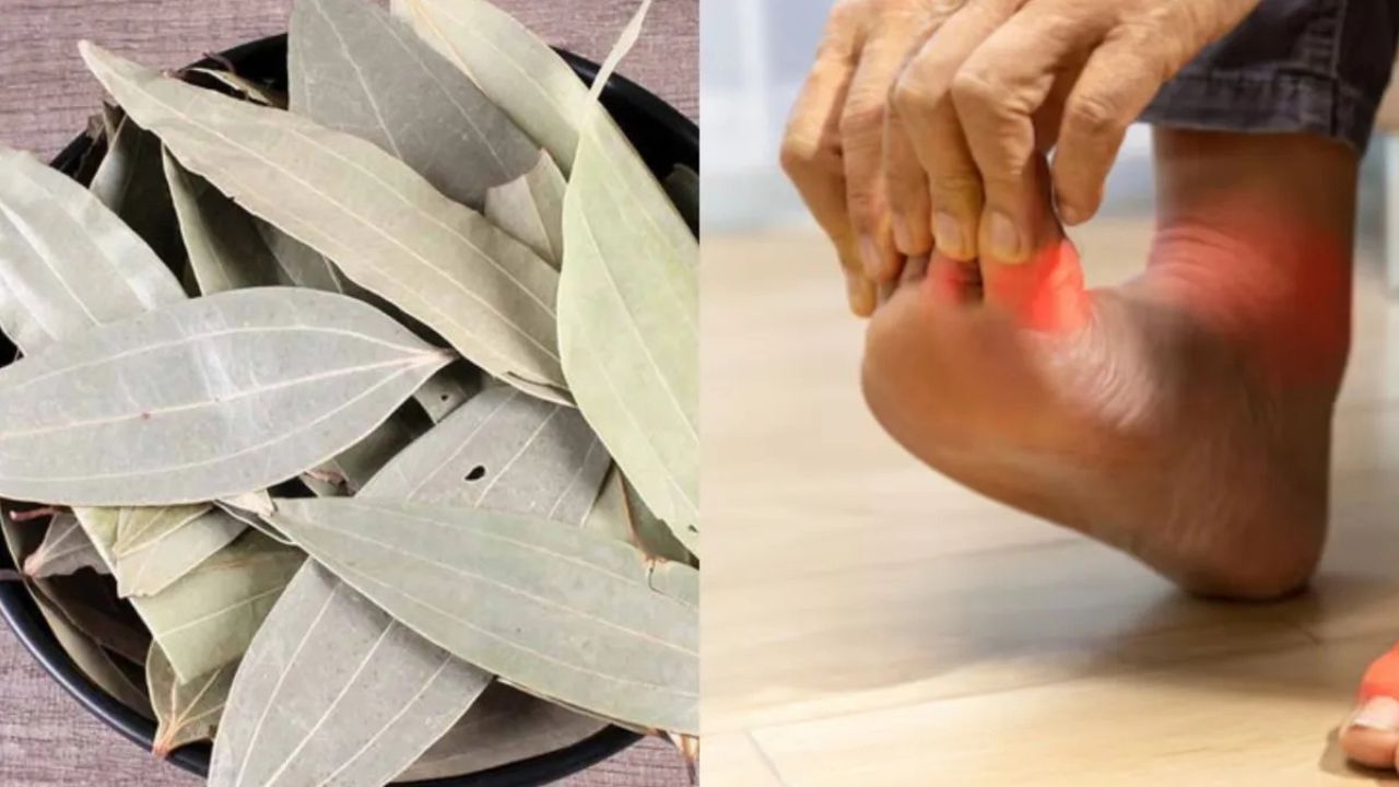 Uric acid: डॉक्टर भी रह गए हैरान! तेजपत्ता ऐसे करता है यूरिक एसिड को कंट्रोल, जानिए चमत्कारी तरीका!